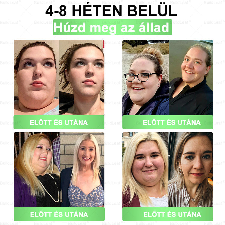 𝖡𝗎𝗂𝗅𝖽𝐿𝑒𝑎𝑓® GLP-1 8 az 1-ben Fit & Vital Szájon át szedhető oldat – Napi egyszer, 7 nap alatt látható változás / Elhízás, szív- és érrendszeri egészség, cukorbetegség, alvási apnoe, bélrendszer egészsége, ízületi problémák és még sok más esetén.