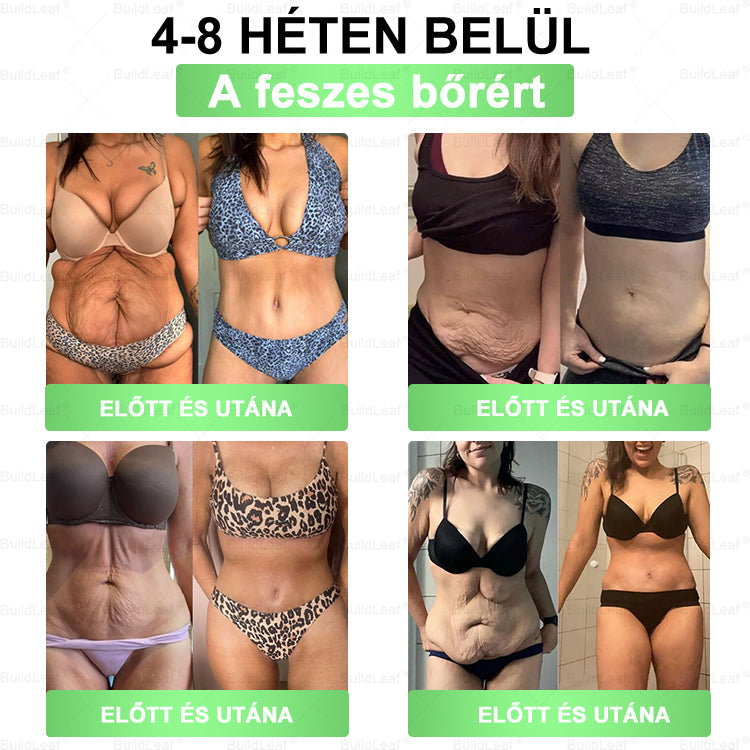 𝖡𝗎𝗂𝗅𝖽𝐿𝑒𝑎𝑓® GLP-1 8 az 1-ben Fit & Vital Szájon át szedhető oldat – Napi egyszer, 7 nap alatt látható változás / Elhízás, szív- és érrendszeri egészség, cukorbetegség, alvási apnoe, bélrendszer egészsége, ízületi problémák és még sok más esetén.